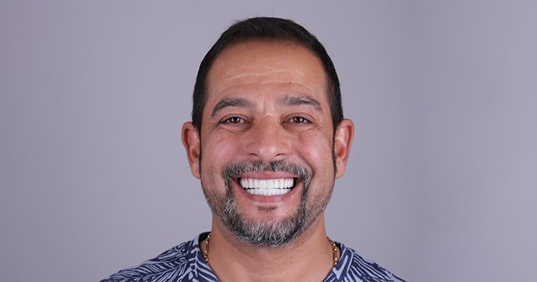 Anestezia generală la maturi – soluția pentru dentofobie